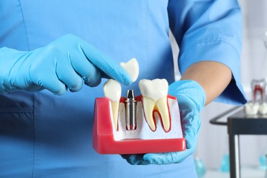 Photo of Dentist putting crown onto abutment of dental implant between teeth in clinic, closeup