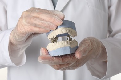 Photo of Doctor holding dental model with jaws on white background, closeup. Cast of teeth