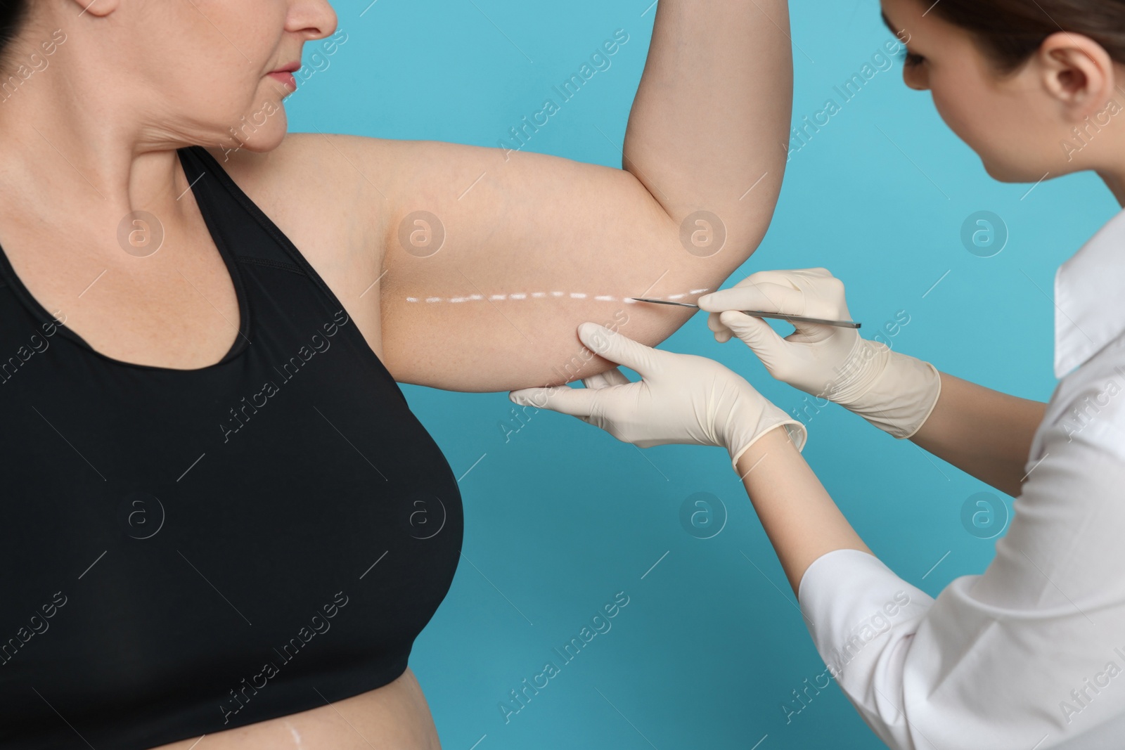 Photo of Doctor with scalpel near obese woman on light blue background, closeup. Weight loss surgery