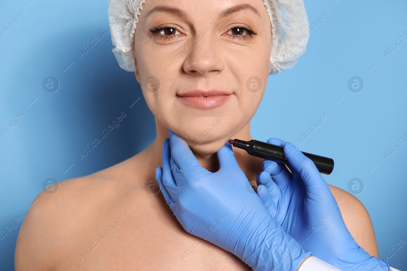 Photo of Surgeon with marker preparing woman for operation against blue background. Double chin removal