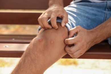 Photo of Man scratching leg with insect bites on bench outdoors, closeup