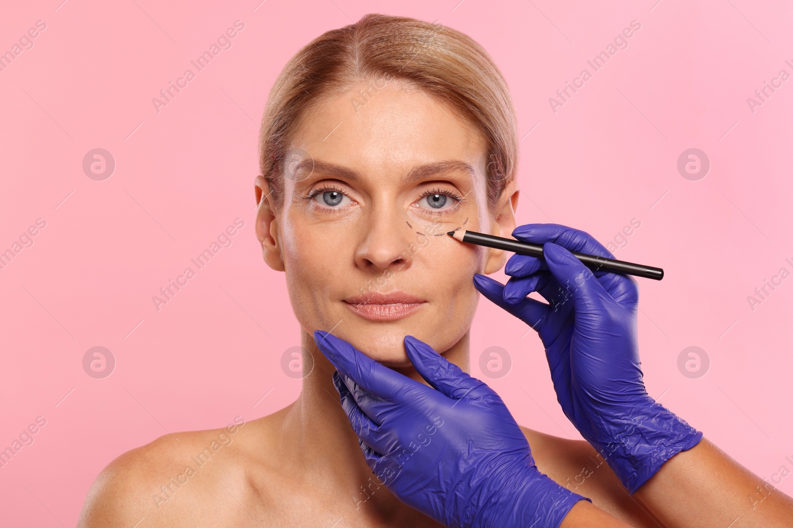 Photo of Doctor with pencil preparing patient for cosmetic surgery operation on pink background