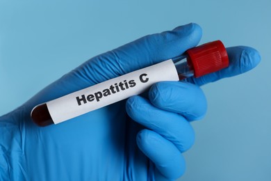 Photo of Scientist holding tube with blood sample and label Hepatitis C on light blue background, closeup