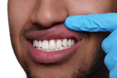 Dentist examining man's gums on white background, closeup