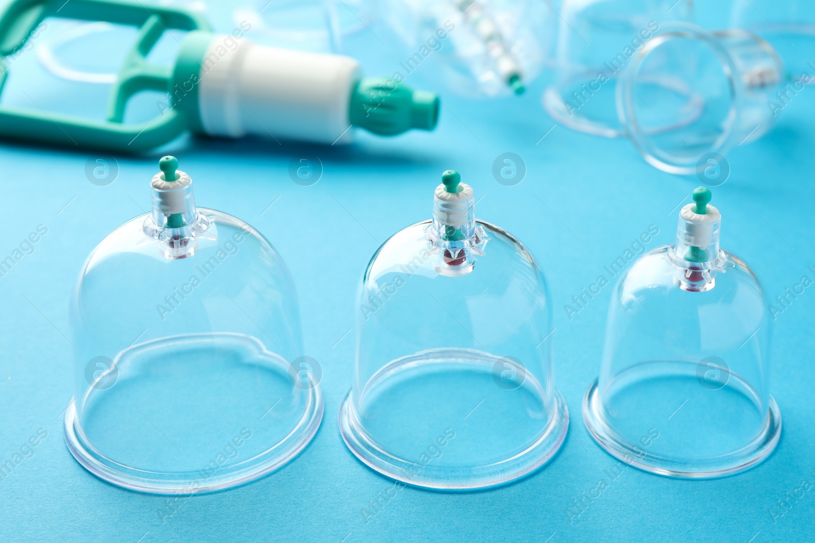 Photo of Plastic cups on light blue background. Cupping therapy