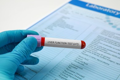 Laboratory worker holding tube with blood sample and label Liver Function Test near form at table, closeup
