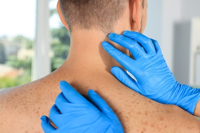 Dermatologist examining patient's birthmark indoors, closeup view