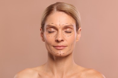 Photo of Portrait of beautiful woman with markings before cosmetic surgery on light brown background