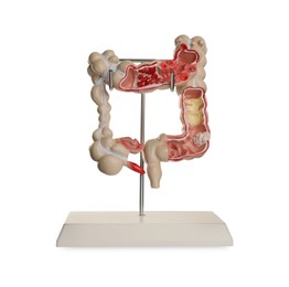 Photo of Anatomical model of large intestine isolated on white. Gastroenterology