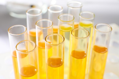 Photo of Tubes with urine samples for analysis on blurred background, closeup