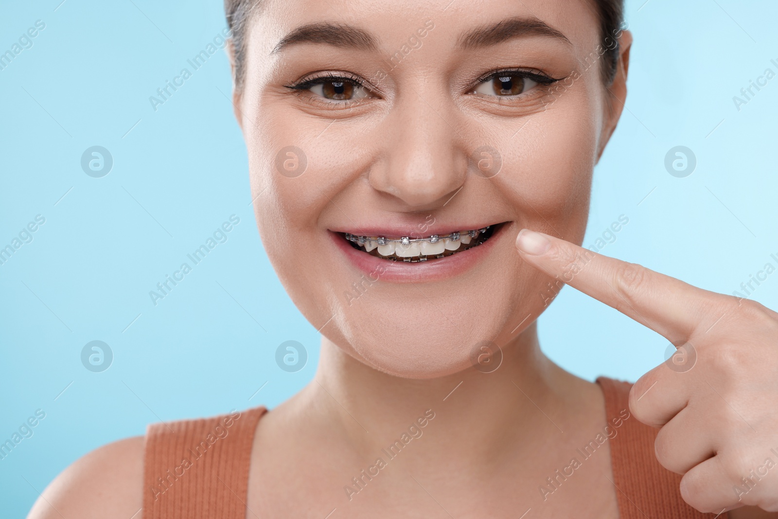 Photo of Smiling woman pointing at braces on her teeth against light blue background, closeup