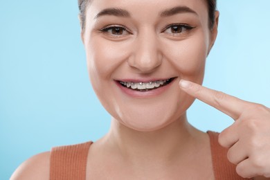 Smiling woman pointing at braces on her teeth against light blue background, closeup