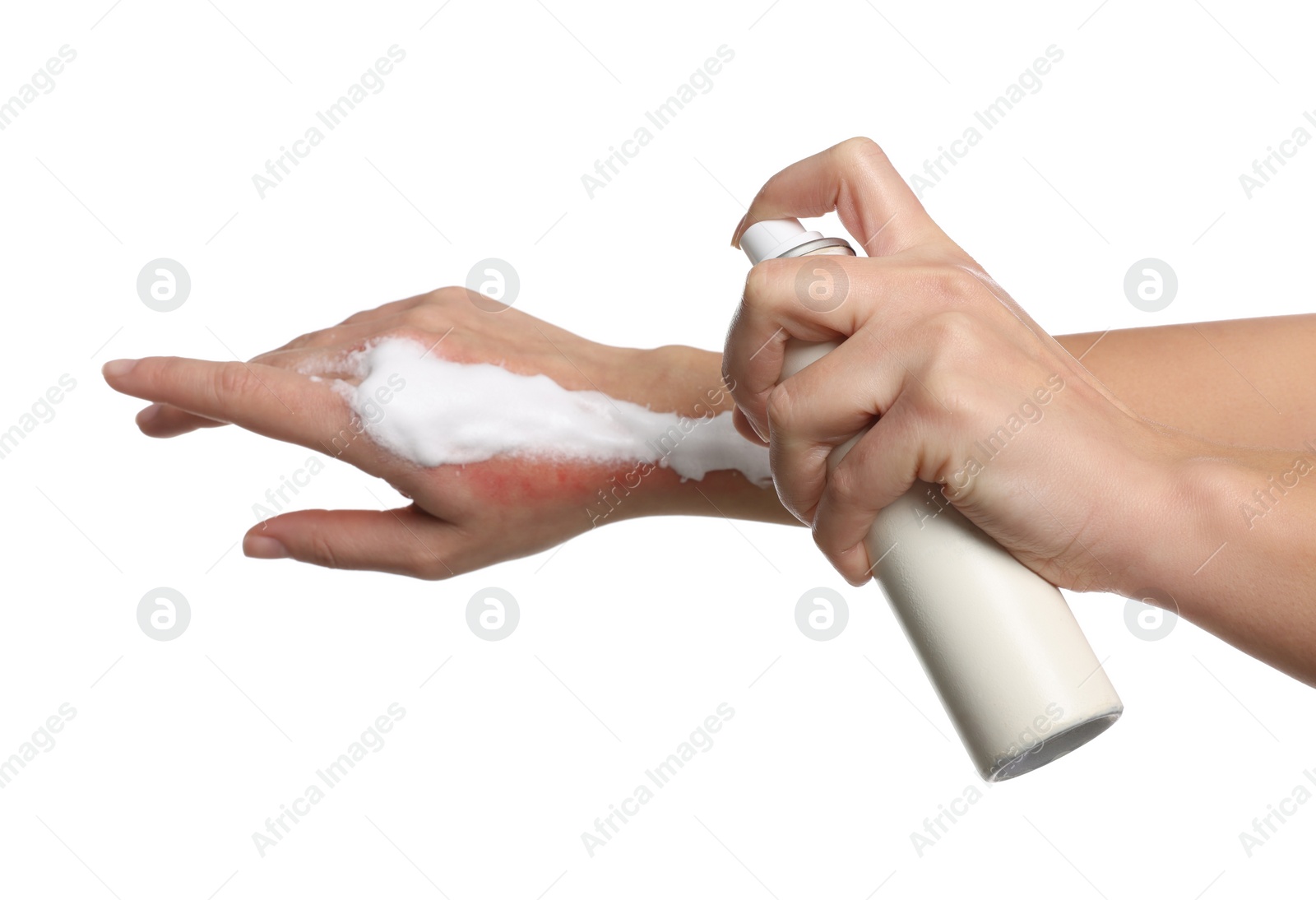 Photo of Woman applying panthenol onto burned hand on white background, closeup