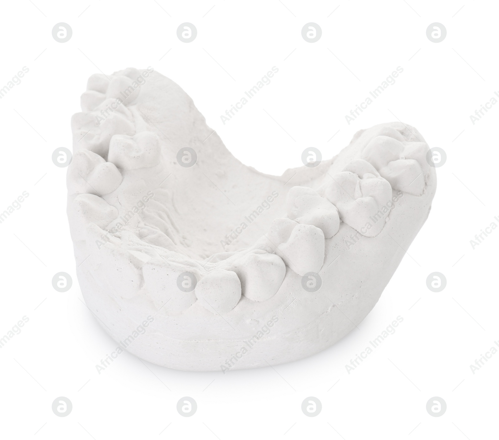 Photo of Dental model with gum isolated on white. Cast of teeth