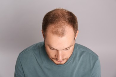 Man with hair loss problem on grey background, above view. Trichology treatment