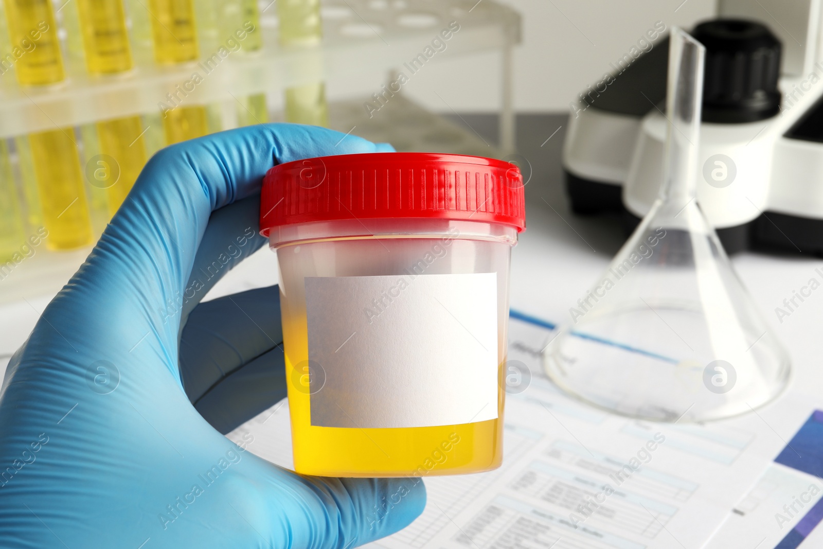 Photo of Nurse holding container with urine sample for analysis at table, closeup