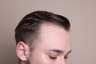 Photo of Baldness concept. Man with receding hairline on beige background, closeup