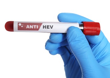 Photo of Scientist holding tube with blood sample and label Anti HEV on white background, closeup