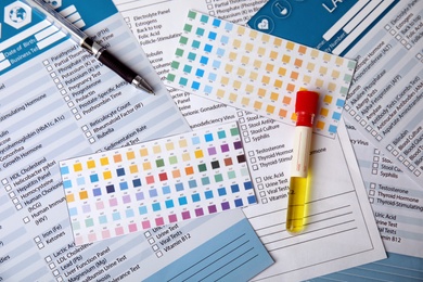 Test tube with urine sample for analysis on laboratory test form, flat lay