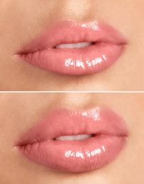 Woman before and after lip correction procedure, closeup 