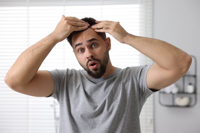 Photo of Emotional man examining his head indoors. Dandruff problem
