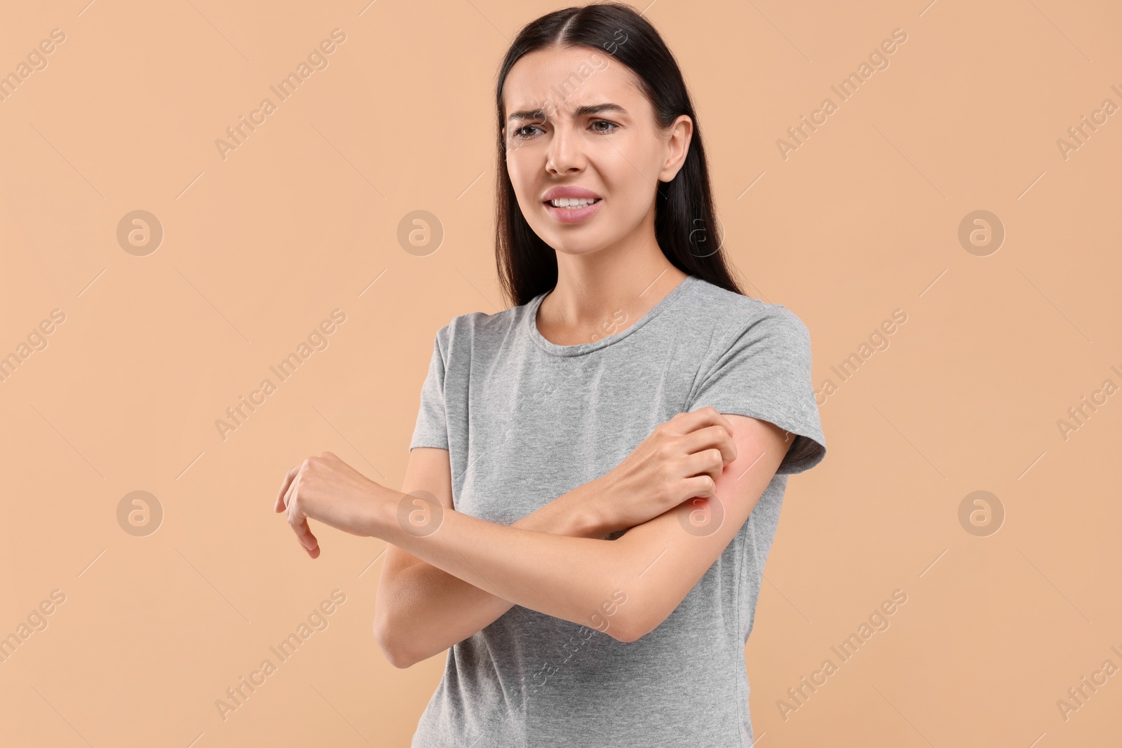 Photo of Suffering from allergy. Young woman scratching her arm on beige background