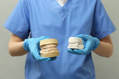 Photo of Doctor holding dental models with jaws on grey background, closeup. Cast of teeth