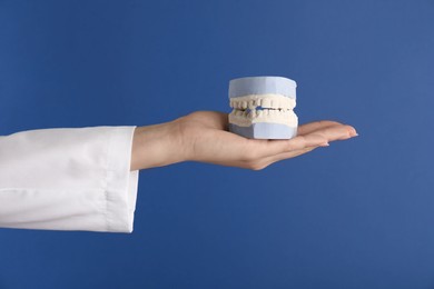 Doctor holding dental model with jaws on blue background, closeup. Cast of teeth