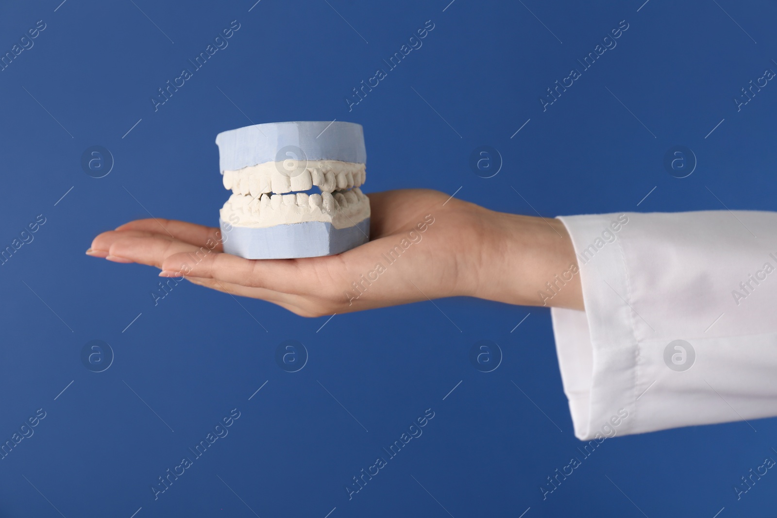 Photo of Doctor holding dental model with jaws on blue background, closeup. Cast of teeth