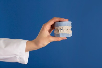 Photo of Doctor holding dental model with jaws on blue background, closeup. Cast of teeth