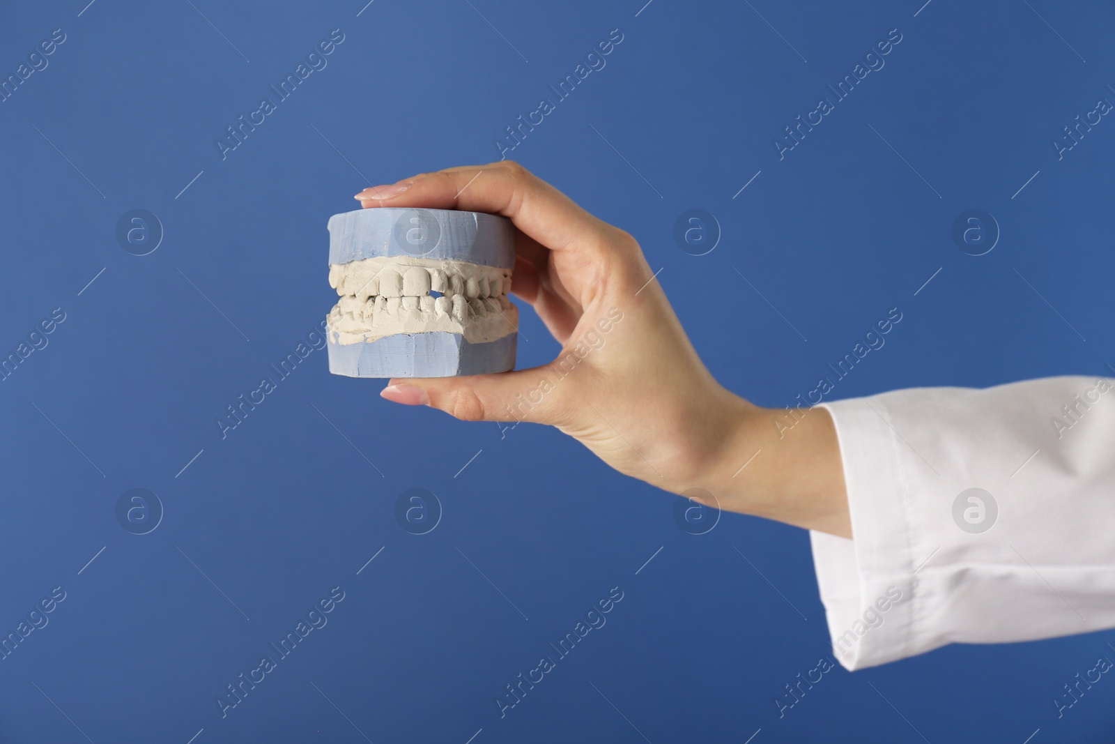 Photo of Doctor holding dental model with jaws on blue background, closeup. Cast of teeth