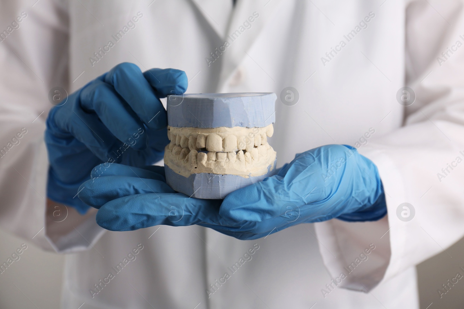 Photo of Doctor holding dental model with jaws on grey background, selective focus. Cast of teeth