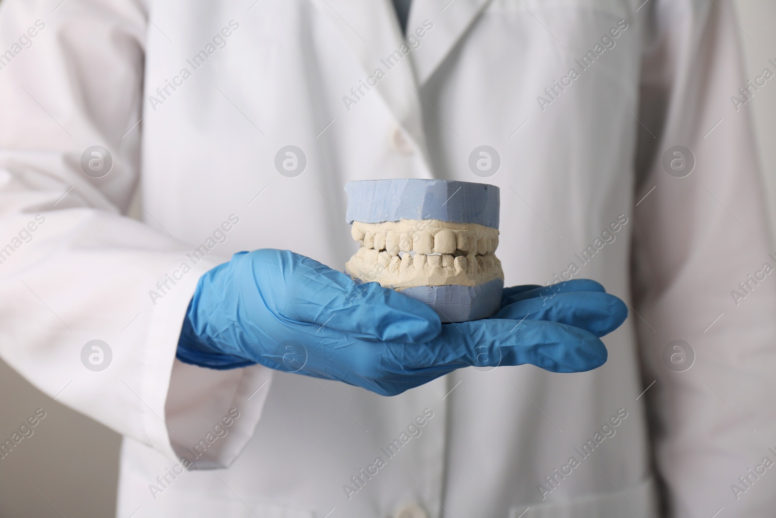 Photo of Doctor holding dental model with jaws on grey background, selective focus. Cast of teeth