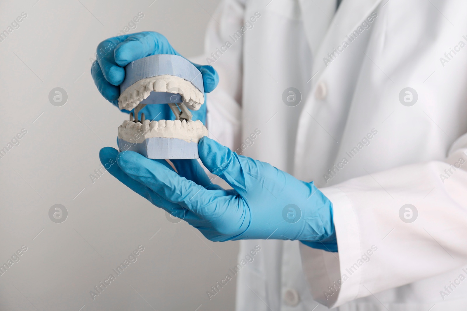 Photo of Doctor holding dental model with jaws on grey background, selective focus. Cast of teeth