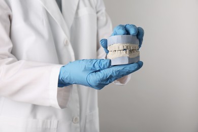 Photo of Doctor holding dental model with jaws on grey background, closeup. Cast of teeth