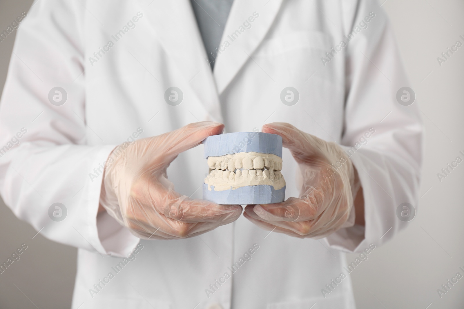 Photo of Doctor holding dental model with jaws on grey background, selective focus. Cast of teeth