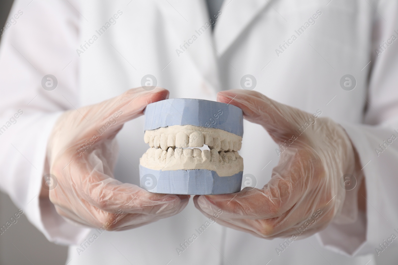 Photo of Doctor holding dental model with jaws on grey background, selective focus. Cast of teeth