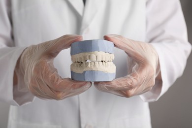 Doctor holding dental model with jaws on grey background, selective focus. Cast of teeth