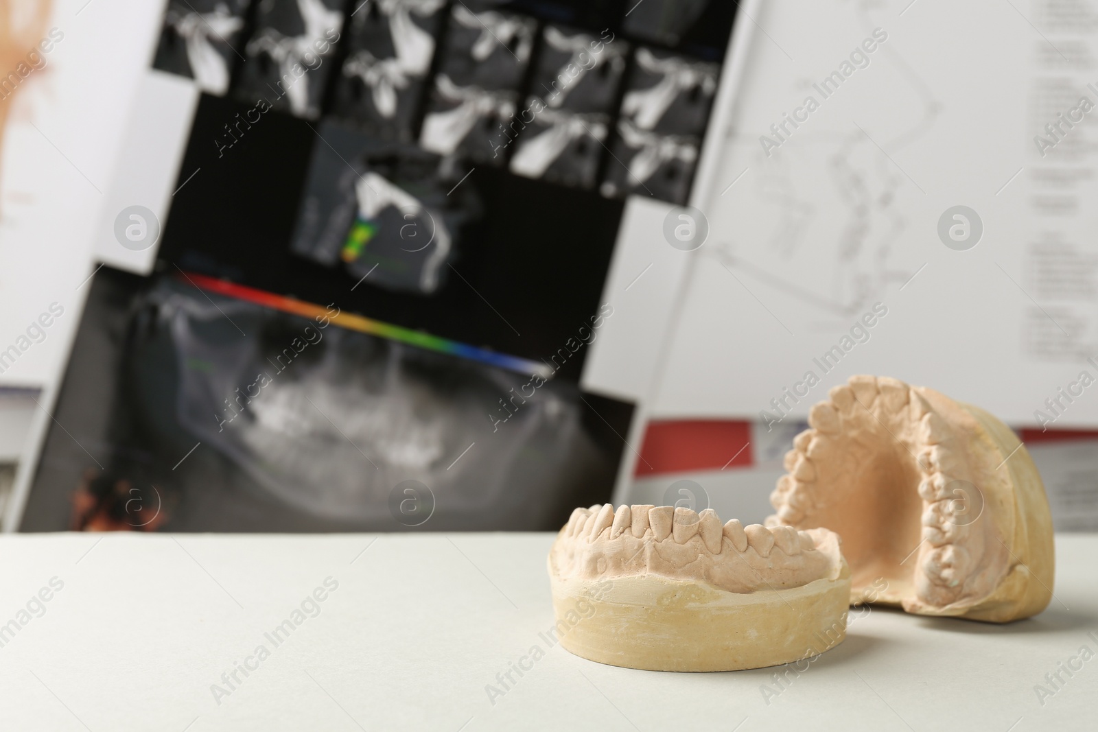 Photo of Dental model with gums on white table against panoramic x-ray, space for text. Cast of teeth