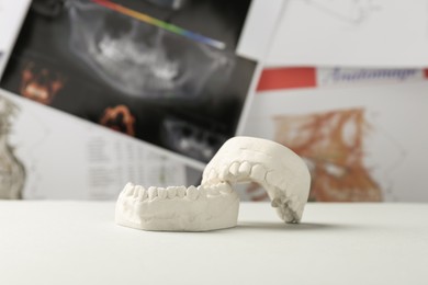 Dental model with gums on white table against panoramic x-ray. Cast of teeth