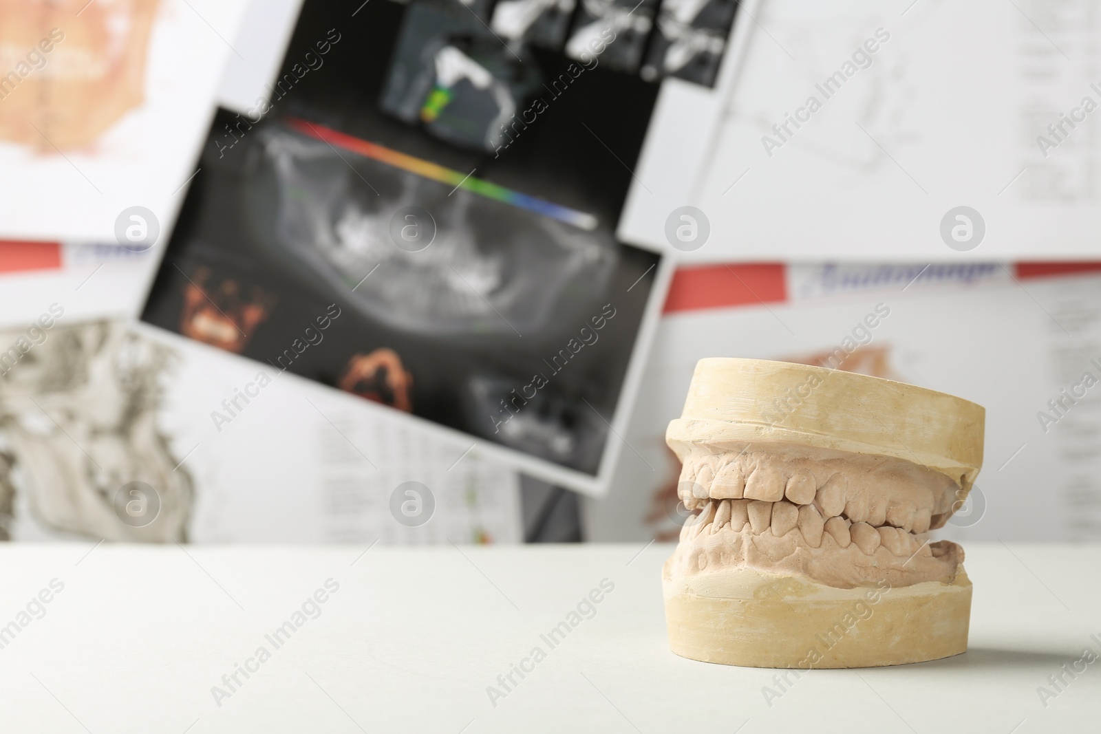 Photo of Dental model with gums on white table against panoramic x-ray, space for text. Cast of teeth