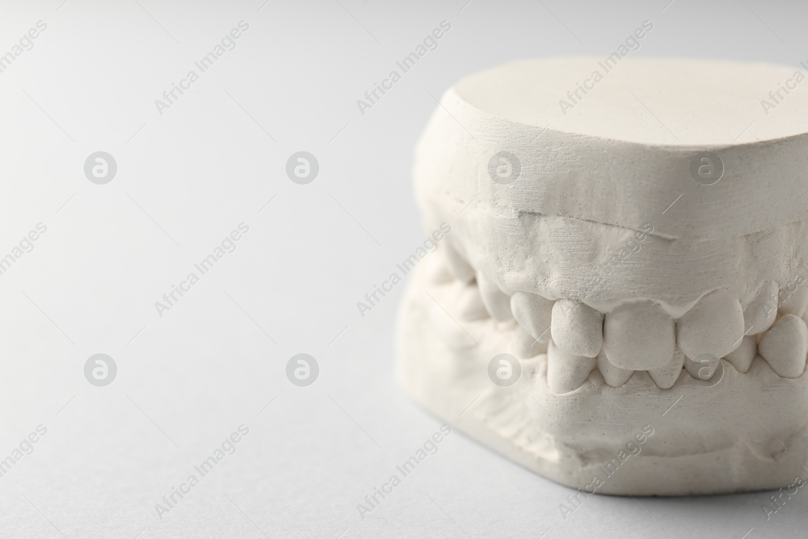 Photo of Dental model with gums on light grey background, closeup and space for text. Cast of teeth