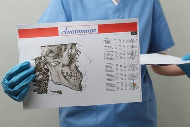 Doctor with visualization of human maxillofacial section for dental analysis printed on papers against grey background, closeup. Cast of teeth