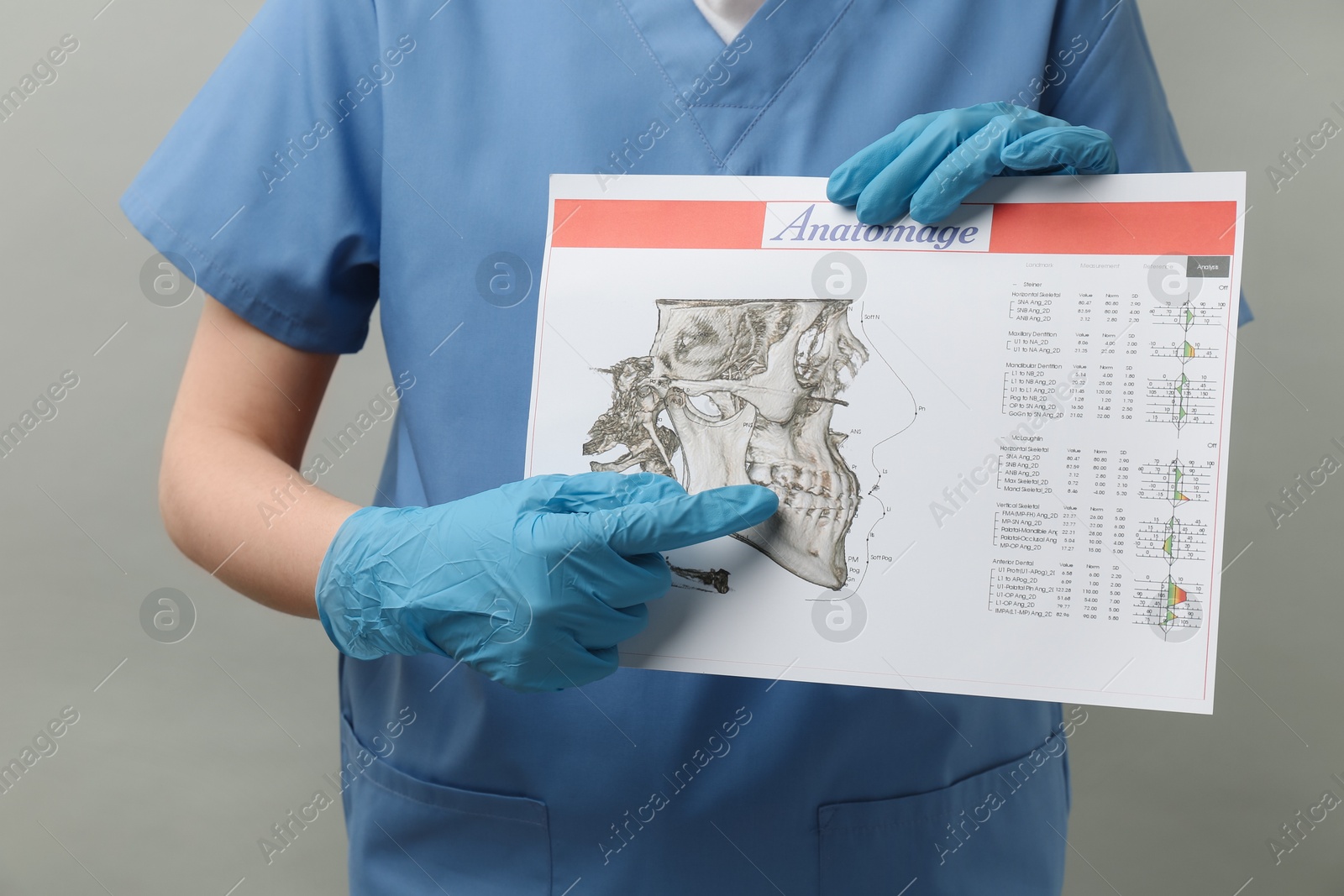 Photo of Doctor with visualization of human maxillofacial section for dental analysis printed on paper against grey background, closeup. Cast of teeth