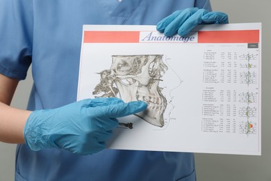 Photo of Doctor with visualization of human maxillofacial section for dental analysis printed on paper against grey background, closeup. Cast of teeth