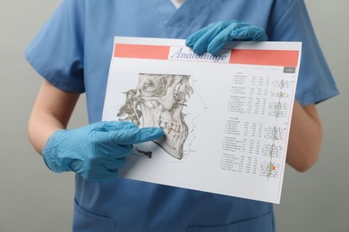 Photo of Doctor with visualization of human maxillofacial section for dental analysis printed on paper against grey background, closeup. Cast of teeth