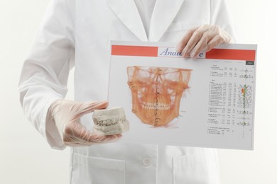 Photo of Doctor holding dental model with jaws and visualization of human maxillofacial section for dental analysis printed on paper against white background, closeup. Cast of teeth