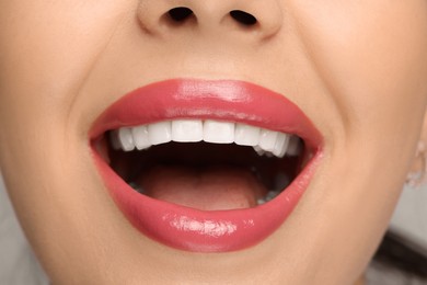 Photo of Smiling woman with healthy teeth, closeup view