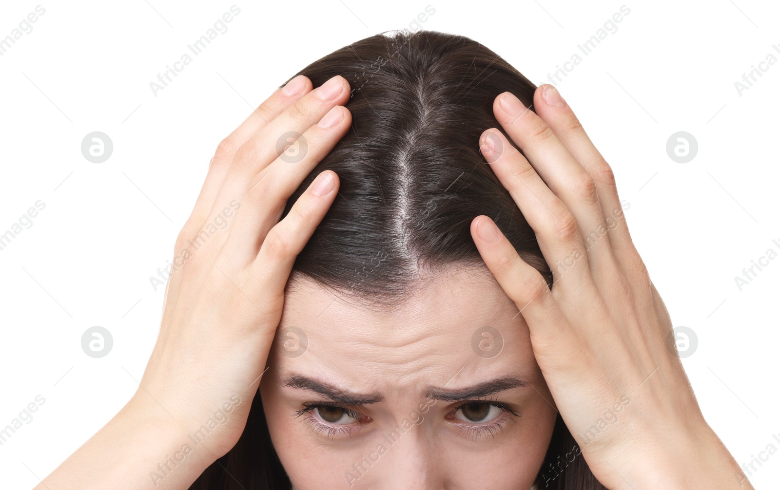 Photo of Young woman with hair loss problem on white background, closeup