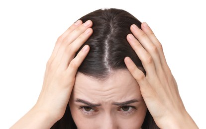 Young woman with hair loss problem on white background, closeup